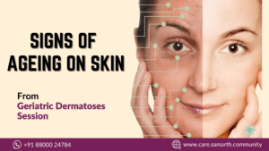 skincare : signs of ageing on skin